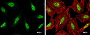 Anti-CDK9 antibody [N3C3] used in Immunocytochemistry/ Immunofluorescence (ICC/IF). GTX107758