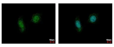 Anti-Casein Kinase 2 alpha antibody used in Immunocytochemistry/ Immunofluorescence (ICC/IF). GTX107897