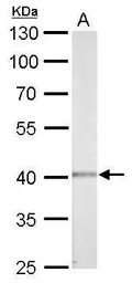 Anti-Casein Kinase 2 alpha antibody used in Western Blot (WB). GTX107897