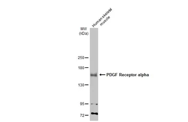 Anti-PDGF Receptor alpha antibody [N2C2], Internal used in Western Blot (WB). GTX107903