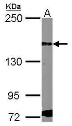 Anti-PDGF Receptor alpha antibody [N2C2], Internal used in Western Blot (WB). GTX107903