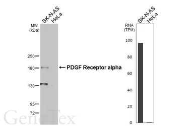 Anti-PDGF Receptor alpha antibody [N2C2], Internal used in Western Blot (WB). GTX107903