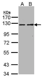 Anti-RIPK5 antibody [C1C3-2] used in Western Blot (WB). GTX107925