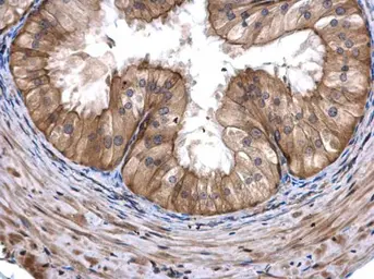 Anti-COASY antibody [N3C3-3] used in IHC (Paraffin sections) (IHC-P). GTX107934