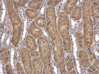 Anti-COASY antibody [N3C3-3] used in IHC (Paraffin sections) (IHC-P). GTX107934