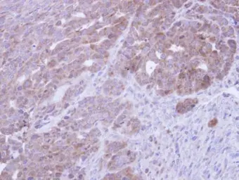 Anti-COASY antibody [N3C3-3] used in IHC (Paraffin sections) (IHC-P). GTX107934