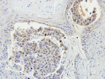Anti-MEKK3 antibody [N3C3] used in IHC (Paraffin sections) (IHC-P). GTX107945