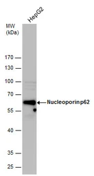 Anti-Nucleoporin p62 antibody used in Western Blot (WB). GTX107973
