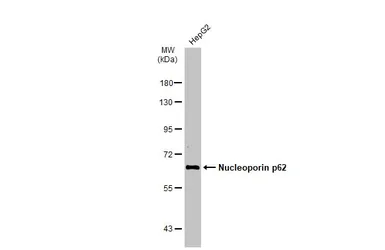 Anti-Nucleoporin p62 antibody used in Western Blot (WB). GTX107973