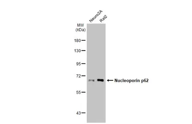 Anti-Nucleoporin p62 antibody used in Western Blot (WB). GTX107973