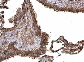 Anti-PKM antibody used in IHC (Paraffin sections) (IHC-P). GTX107977