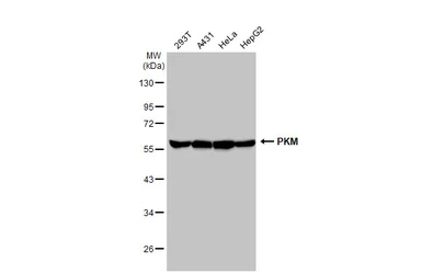 Anti-PKM antibody used in Western Blot (WB). GTX107977