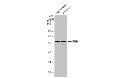 Anti-PKM antibody used in Western Blot (WB). GTX107977