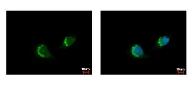 Anti-ETEA antibody [C3], C-term used in Immunocytochemistry/ Immunofluorescence (ICC/IF). GTX107993