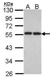 Anti-ETEA antibody [C3], C-term used in Western Blot (WB). GTX107993