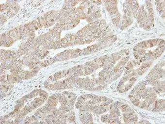 Anti-GSTA1 antibody used in IHC (Paraffin sections) (IHC-P). GTX108012