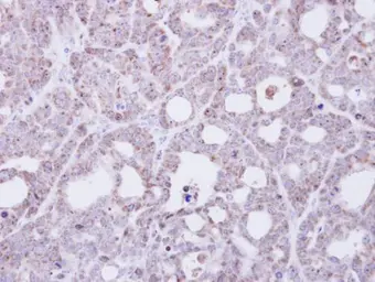 Anti-Transmembrane protein 147 antibody [N1C1] used in IHC (Paraffin sections) (IHC-P). GTX108045
