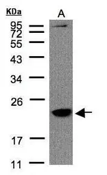 Anti-Transmembrane protein 147 antibody [N1C1] used in Western Blot (WB). GTX108045