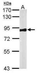 Anti-VPS35 antibody [C3], C-term used in Western Blot (WB). GTX108058