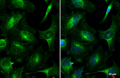 Anti-VPS35 antibody [C3], C-term used in Immunocytochemistry/ Immunofluorescence (ICC/IF). GTX108058