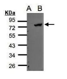 Anti-ELMO2 antibody [C3], C-term used in Western Blot (WB). GTX108070