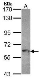 Anti-MTMR9 antibody [C3], C-term used in Western Blot (WB). GTX108078