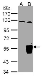 Anti-TRIM15 antibody [N1], N-term used in Western Blot (WB). GTX108094