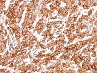 Anti-CysLT1 Receptor antibody [N1], N-term used in IHC (Paraffin sections) (IHC-P). GTX108112