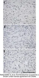 Anti-GALR3 antibody used in IHC (Paraffin sections) (IHC-P). GTX108163