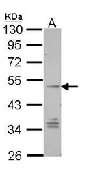 Anti-TM7SF1/GPR137B antibody [C3], C-term used in Western Blot (WB). GTX108191