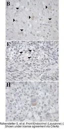 Anti-GALR1 antibody [C2C3], C-term used in IHC (Paraffin sections) (IHC-P). GTX108207