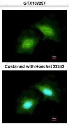 Anti-GADD45G antibody [C1C3] used in Immunocytochemistry/ Immunofluorescence (ICC/IF). GTX108257
