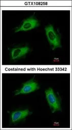 Anti-ARL1 antibody used in Immunocytochemistry/ Immunofluorescence (ICC/IF). GTX108258