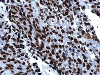 Anti-Histone H2A.X antibody used in IHC (Paraffin sections) (IHC-P). GTX108272
