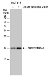 Anti-Histone H2A.X antibody used in Western Blot (WB). GTX108272