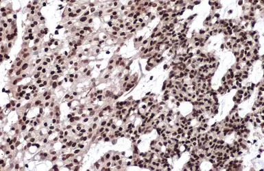 Anti-Histone H2A.X antibody used in IHC (Paraffin sections) (IHC-P). GTX108272