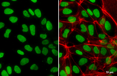 Anti-Histone H2A.Z antibody used in Immunocytochemistry/ Immunofluorescence (ICC/IF). GTX108273