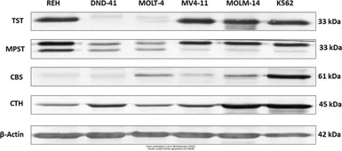Anti-MPST antibody [C2C3], C-term used in Western Blot (WB). GTX108274