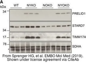 Anti-TIM17 antibody [C1C3] used in Western Blot (WB). GTX108280