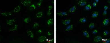 Anti-TIM17 antibody [C1C3] used in Immunocytochemistry/ Immunofluorescence (ICC/IF). GTX108280