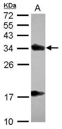 Anti-alpha TTP antibody [C2C3], C-term used in Western Blot (WB). GTX108286