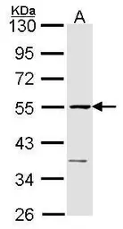 Anti-eRF1 antibody used in Western Blot (WB). GTX108296