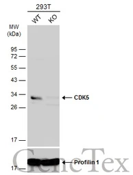 Anti-CDK5 antibody [C2C3], C-term used in Western Blot (WB). GTX108328