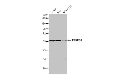Anti-PFKFB3 antibody [C3], C-term used in Western Blot (WB). GTX108335
