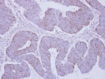 Anti-PHKA2 antibody [C3], C-term used in IHC (Paraffin sections) (IHC-P). GTX108342