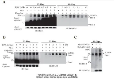 Anti-HES1 antibody [N1], N-term used in Western Blot (WB). GTX108356