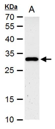 Anti-HES1 antibody [N1], N-term used in Western Blot (WB). GTX108356