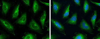 Anti-P Glycoprotein antibody used in Immunocytochemistry/ Immunofluorescence (ICC/IF). GTX108370