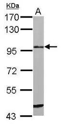 Anti-Matriptase / ST14 antibody used in Western Blot (WB). GTX108375