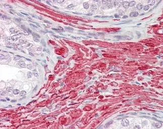 Anti-GREM2 antibody [C1C3] used in IHC (Paraffin sections) (IHC-P). GTX108414